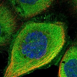 Invitrogen DDIAS Polyclonal Antibody 100 &mu;L; Unconjugated:Antibodies,