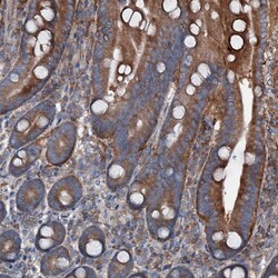 Invitrogen DDIAS Polyclonal Antibody 100 &mu;L; Unconjugated:Antibodies,