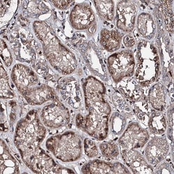Invitrogen DDIAS Polyclonal Antibody 100 &mu;L; Unconjugated:Antibodies,