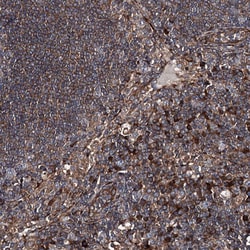 Invitrogen DDIAS Polyclonal Antibody 100 &mu;L; Unconjugated:Antibodies,