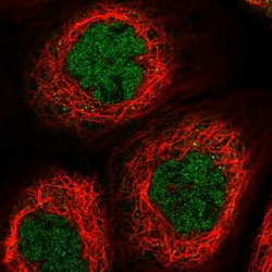 Invitrogen TTC12 Polyclonal Antibody 100 &mu;L; Unconjugated:Antibodies,