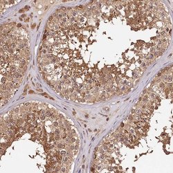 Invitrogen TTC12 Polyclonal Antibody 100 &mu;L; Unconjugated:Antibodies,