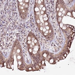 Invitrogen TAP26 Polyclonal Antibody 100 &mu;L; Unconjugated:Antibodies,