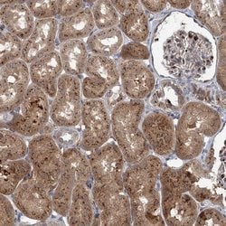 Invitrogen ELP4 Polyclonal Antibody 100 &mu;L; Unconjugated:Antibodies,