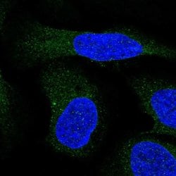 Invitrogen ALG9 Polyclonal Antibody 100 &mu;L; Unconjugated:Antibodies,