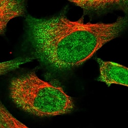 Invitrogen RNF111 Polyclonal Antibody 100 &mu;L; Unconjugated:Antibodies,