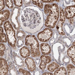 Invitrogen RNF111 Polyclonal Antibody 100 &mu;L; Unconjugated:Antibodies,