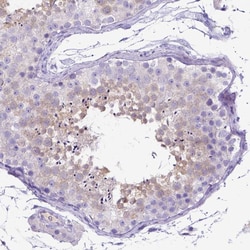 Invitrogen C11orf70 Polyclonal Antibody 100 &mu;L; Unconjugated:Antibodies,