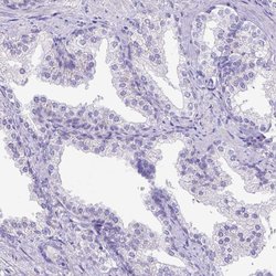 Invitrogen C11orf70 Polyclonal Antibody 100 &mu;L; Unconjugated:Antibodies,