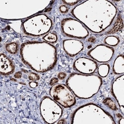 Invitrogen ACTR6 Polyclonal Antibody 100 &mu;L; Unconjugated:Antibodies,