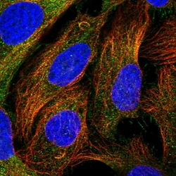 Invitrogen CEP295 Polyclonal Antibody 100 &mu;L; Unconjugated:Antibodies,