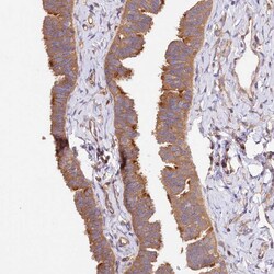 Invitrogen CEP295 Polyclonal Antibody 100 &mu;L | Buy Online | Invitrogen&trade; | Fisher Scientific