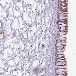 Invitrogen CTRP5 Polyclonal Antibody 100 &mu;L; Unconjugated:Antibodies,