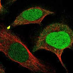 Invitrogen FAM111B Polyclonal Antibody 100 &mu;L; Unconjugated:Antibodies,