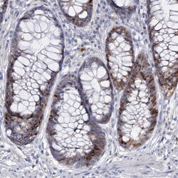 Invitrogen FAM111B Polyclonal Antibody 100 &mu;L; Unconjugated:Antibodies,