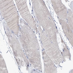 Invitrogen FAM111B Polyclonal Antibody 100 &mu;L; Unconjugated:Antibodies,
