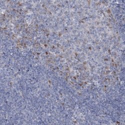 Invitrogen FAM111B Polyclonal Antibody 100 &mu;L; Unconjugated:Antibodies,