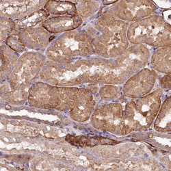 Invitrogen SPATS2 Polyclonal Antibody 100 &mu;L; Unconjugated:Antibodies,