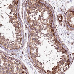 Invitrogen SPATS2 Polyclonal Antibody 100 &mu;L; Unconjugated:Antibodies,