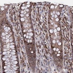 Invitrogen TBC1D12 Polyclonal Antibody 100 &mu;L; Unconjugated:Antibodies,
