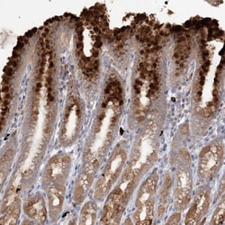 Invitrogen SLC41A2 Polyclonal Antibody 100 &mu;L; Unconjugated:Antibodies,