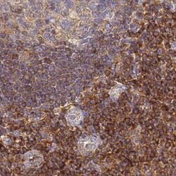 Invitrogen BIN2 Polyclonal Antibody 100 &mu;L; Unconjugated:Antibodies,