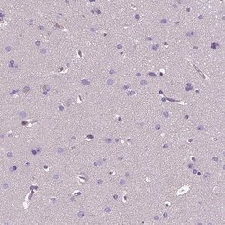 Invitrogen EFCAB4B Polyclonal Antibody 100 &mu;L; Unconjugated:Antibodies,