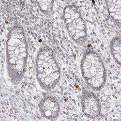 Invitrogen LY6G5C Polyclonal Antibody 100 &mu;L; Unconjugated:Antibodies,