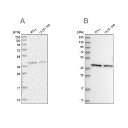 Invitrogen PSMD13 Polyclonal Antibody 100 &mu;L; Unconjugated:Antibodies,