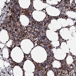 Invitrogen FGFR1OP2 Polyclonal Antibody 100 &mu;L; Unconjugated:Antibodies,