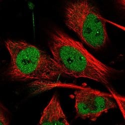 Invitrogen MON2 Polyclonal Antibody 100 &mu;L; Unconjugated:Antibodies,