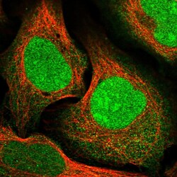 Invitrogen CCDC82 Polyclonal Antibody 100 &mu;L; Unconjugated:Antibodies,