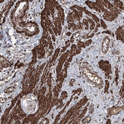 Invitrogen CCDC82 Polyclonal Antibody 100 &mu;L; Unconjugated:Antibodies,