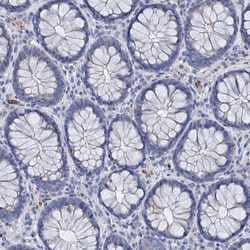 Invitrogen ATG2A Polyclonal Antibody 100 &mu;L; Unconjugated:Antibodies,