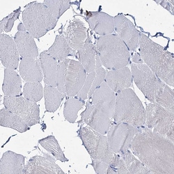 Invitrogen ATG2A Polyclonal Antibody 100 &mu;L; Unconjugated:Antibodies,