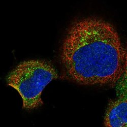 Invitrogen RBP5 Polyclonal Antibody 100 &mu;L; Unconjugated:Antibodies,