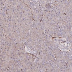 Invitrogen RBP5 Polyclonal Antibody 100 &mu;L; Unconjugated:Antibodies,