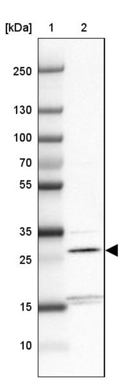 Invitrogen THYN1 Polyclonal Antibody 100 &mu;L | Buy Online | Invitrogen&trade; | Fisher Scientific