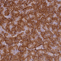 Invitrogen RPL13A Polyclonal Antibody 100 &mu;L | Buy Online | Invitrogen&trade; | Fisher Scientific