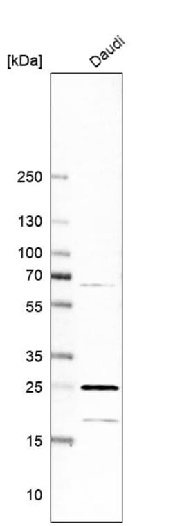 Invitrogen RPL13A Polyclonal Antibody 100 &mu;L | Buy Online | Invitrogen&trade; | Fisher Scientific