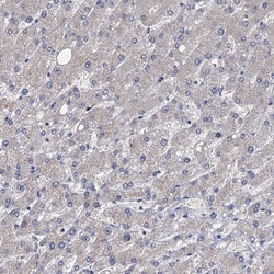 Invitrogen EYA4 Polyclonal Antibody 100 &mu;L; Unconjugated:Antibodies,