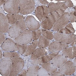 Invitrogen EYA4 Polyclonal Antibody 100 &mu;L; Unconjugated:Antibodies,