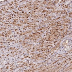 Invitrogen FUNDC1 Polyclonal Antibody 100 &mu;L; Unconjugated:Antibodies,