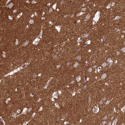 Invitrogen CD99L2 Polyclonal Antibody 100 &mu;L; Unconjugated:Antibodies,
