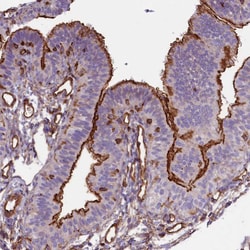 Invitrogen CD99L2 Polyclonal Antibody 100 &mu;L; Unconjugated:Antibodies,