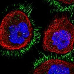 Invitrogen CD99L2 Polyclonal Antibody 100 &mu;L; Unconjugated:Antibodies,