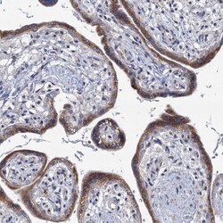 Invitrogen PRSS35 Polyclonal Antibody 100 &mu;L; Unconjugated:Antibodies,