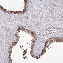 Invitrogen RRP9 Polyclonal Antibody 100 &mu;L; Unconjugated:Antibodies,