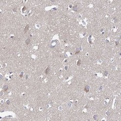 Invitrogen RICH2 Polyclonal Antibody 100 &mu;L; Unconjugated:Antibodies,