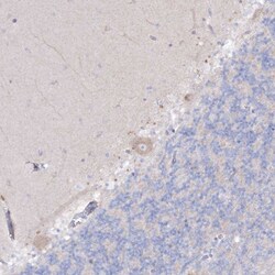 Invitrogen NAGLU Polyclonal Antibody 100 &mu;L; Unconjugated:Antibodies,